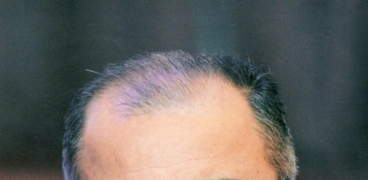 Azərbaycan Dövlət Bədən Tərbiyəsi və İdman Akademiyasının rektoru Fuad Hacıyevin doğum günüdür